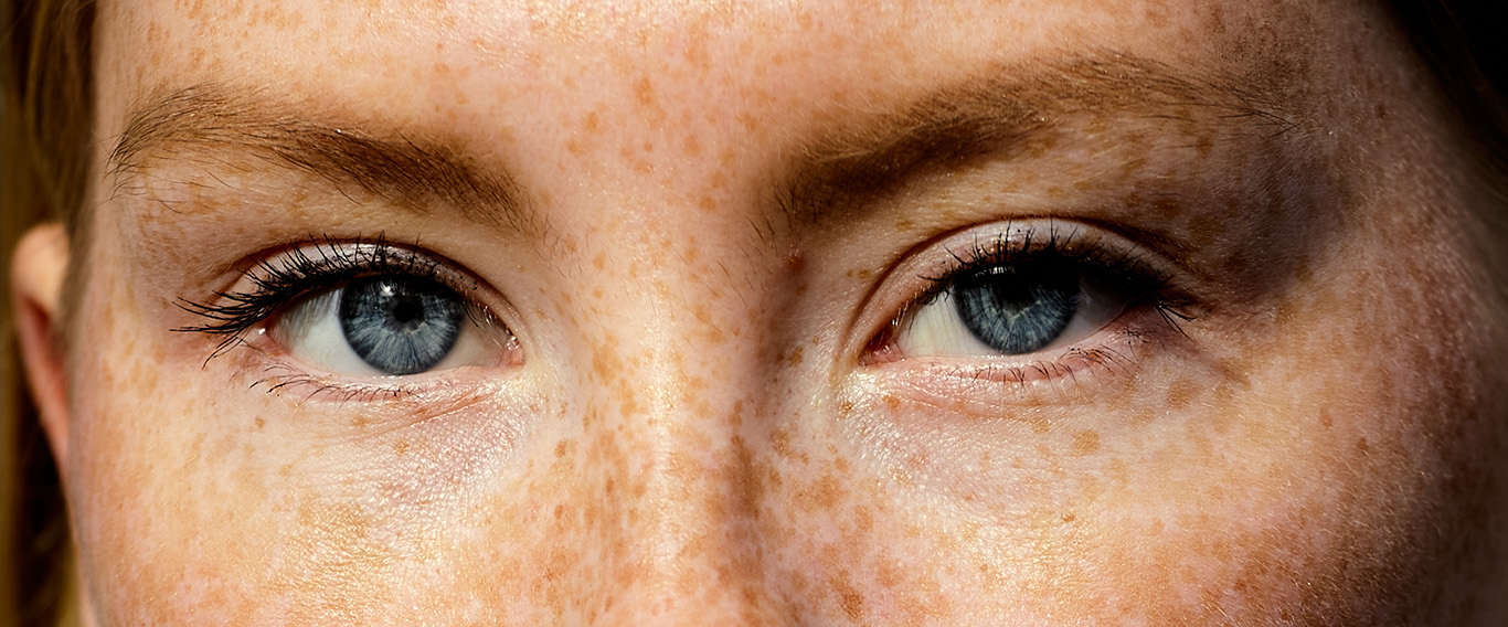 Retrato editorial de una modelo con pecas y ojos azules mirando a cámara.